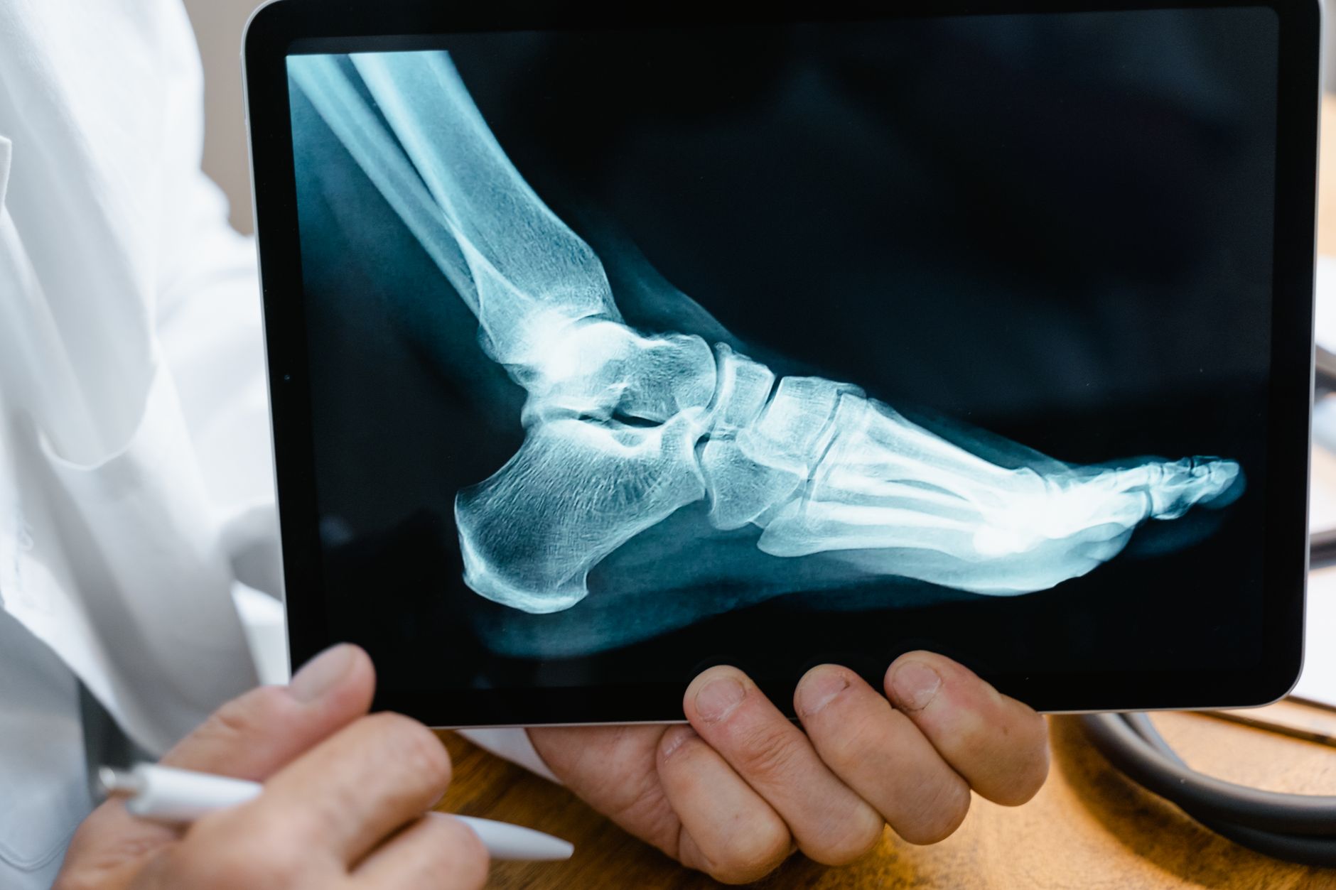 A doctor reviews a foot X-ray on a digital tablet in a