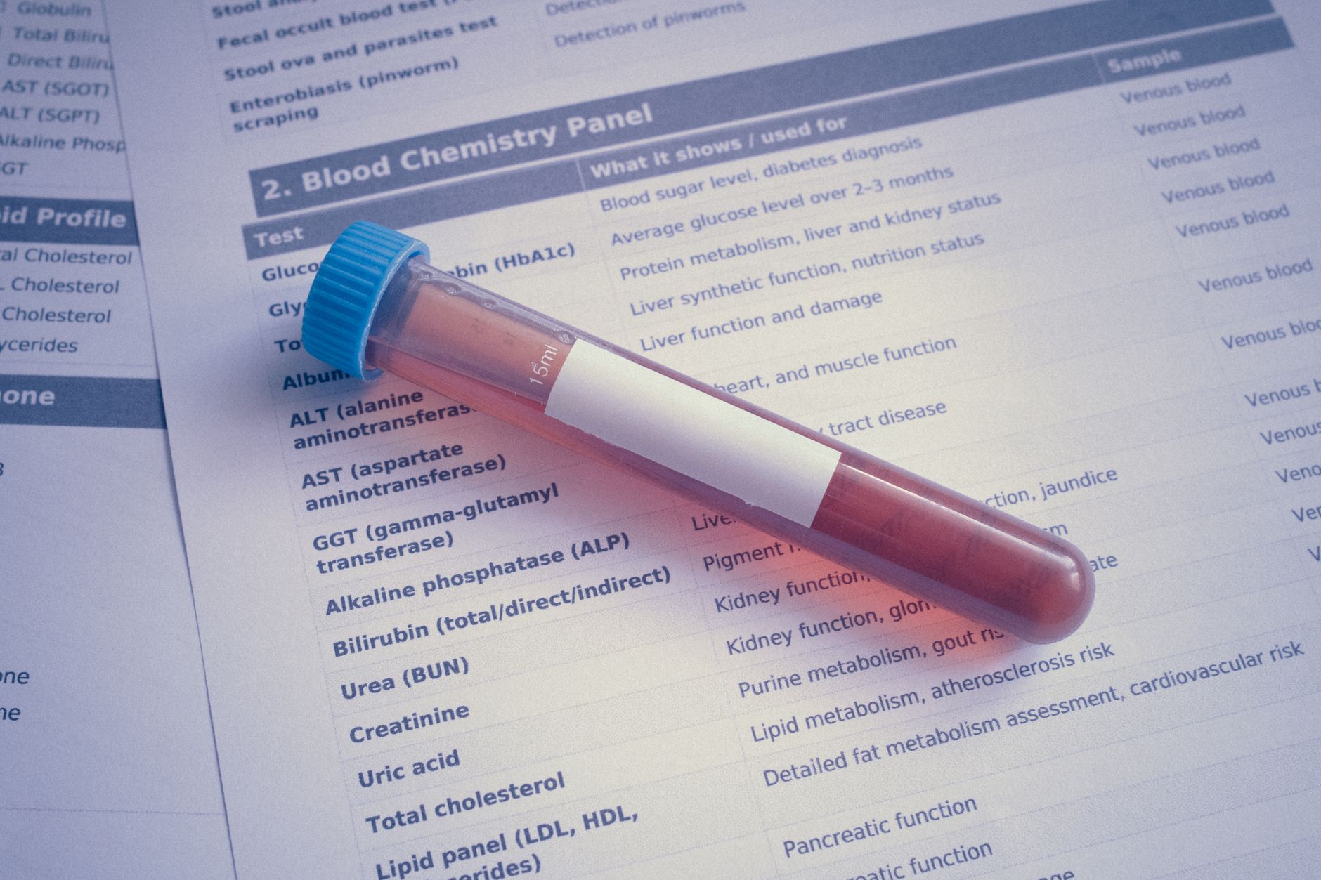 A blood sample tube placed on a chemistry panel document, showcasing medical
